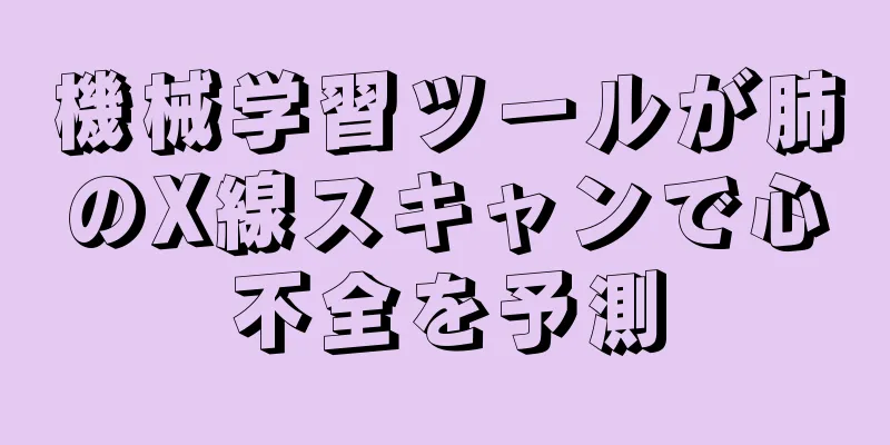 機械学習ツールが肺のX線スキャンで心不全を予測